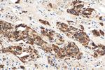 Prolactin Antibody in Immunohistochemistry (Paraffin) (IHC (P))