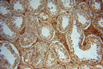 METTL6 Antibody in Immunohistochemistry (Paraffin) (IHC (P))