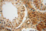 METTL6 Antibody in Immunohistochemistry (Paraffin) (IHC (P))