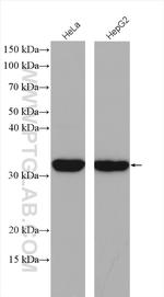 METTL6 Antibody in Western Blot (WB)