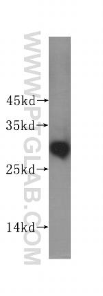 METTL6 Antibody in Western Blot (WB)