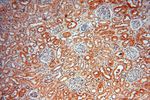 LARP4 Antibody in Immunohistochemistry (Paraffin) (IHC (P))