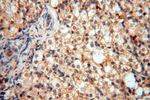 LARP4 Antibody in Immunohistochemistry (Paraffin) (IHC (P))