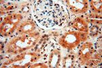LARP4 Antibody in Immunohistochemistry (Paraffin) (IHC (P))