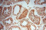 LARP4 Antibody in Immunohistochemistry (Paraffin) (IHC (P))