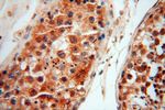 LARP4 Antibody in Immunohistochemistry (Paraffin) (IHC (P))