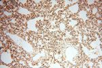 LARP4 Antibody in Immunohistochemistry (Paraffin) (IHC (P))
