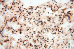 LARP4 Antibody in Immunohistochemistry (Paraffin) (IHC (P))