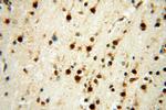 LARP4 Antibody in Immunohistochemistry (Paraffin) (IHC (P))