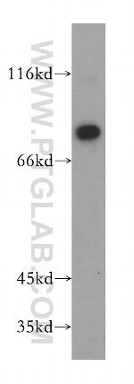 LARP4 Antibody in Western Blot (WB)