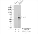 SERPINA7/TBG Antibody in Immunoprecipitation (IP)