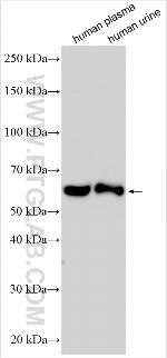 SERPINA7/TBG Antibody in Western Blot (WB)