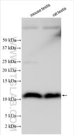 DYNLRB2 Antibody in Western Blot (WB)