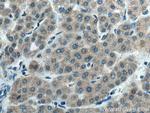 CYP2C8 Antibody in Immunohistochemistry (Paraffin) (IHC (P))