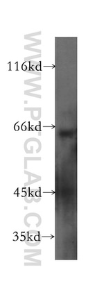 CCKBR Antibody in Western Blot (WB)