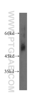 CCKBR Antibody in Western Blot (WB)