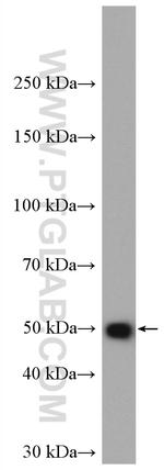 GLI4 Antibody in Western Blot (WB)