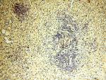 CYP19A1 Antibody in Immunohistochemistry (Paraffin) (IHC (P))