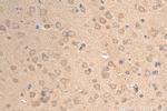CYP19A1 Antibody in Immunohistochemistry (Paraffin) (IHC (P))