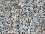 CYP19A1 Antibody in Immunohistochemistry (Paraffin) (IHC (P))
