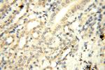CYP19A1 Antibody in Immunohistochemistry (Paraffin) (IHC (P))