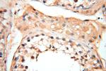 CYP19A1 Antibody in Immunohistochemistry (Paraffin) (IHC (P))