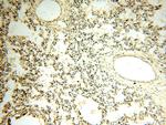 CYP19A1 Antibody in Immunohistochemistry (Paraffin) (IHC (P))