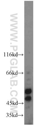 CYP19A1 Antibody in Western Blot (WB)