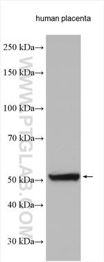 CYP19A1 Antibody in Western Blot (WB)