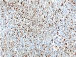 CD16 Antibody in Immunohistochemistry (Paraffin) (IHC (P))