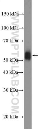 CD16 Antibody in Western Blot (WB)