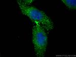 HAO2 Antibody in Immunocytochemistry (ICC/IF)