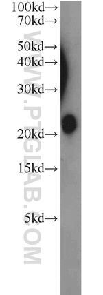 TMEM11 Antibody in Western Blot (WB)