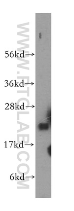 TMEM11 Antibody in Western Blot (WB)