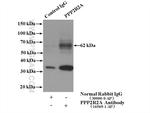 PPP2R2A Antibody in Immunoprecipitation (IP)