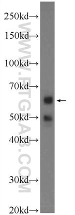 PPP2R2A Antibody in Western Blot (WB)