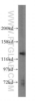 POLR3B Antibody in Western Blot (WB)