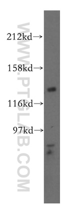 POLR3B Antibody in Western Blot (WB)