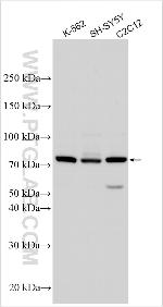 NAAA Antibody in Western Blot (WB)