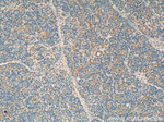 NT5C Antibody in Immunohistochemistry (Paraffin) (IHC (P))