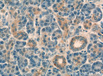 NT5C Antibody in Immunohistochemistry (Paraffin) (IHC (P))