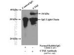 CTSZ Antibody in Immunoprecipitation (IP)