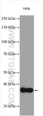 CTSZ Antibody in Western Blot (WB)