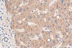 CFHR3 Antibody in Immunohistochemistry (Paraffin) (IHC (P))