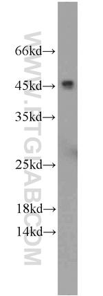 CFHR3 Antibody in Western Blot (WB)