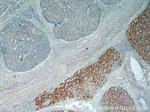 MRPL3 Antibody in Immunohistochemistry (Paraffin) (IHC (P))
