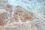 MRPL3 Antibody in Immunohistochemistry (Paraffin) (IHC (P))