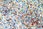 MRPL3 Antibody in Immunohistochemistry (Paraffin) (IHC (P))