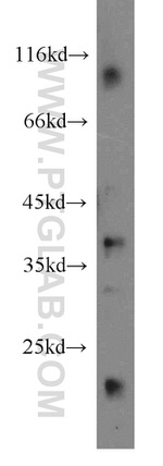 MRPL3 Antibody in Western Blot (WB)