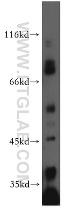 MRPL3 Antibody in Western Blot (WB)